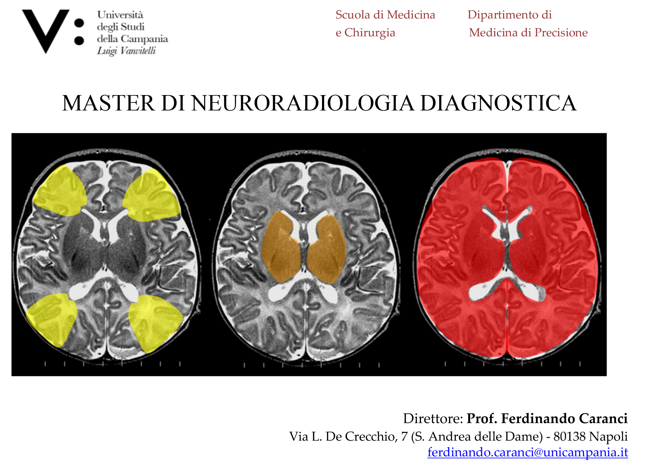 MASTER DI NEURORADIOLOGIA DIAGNOSTICA