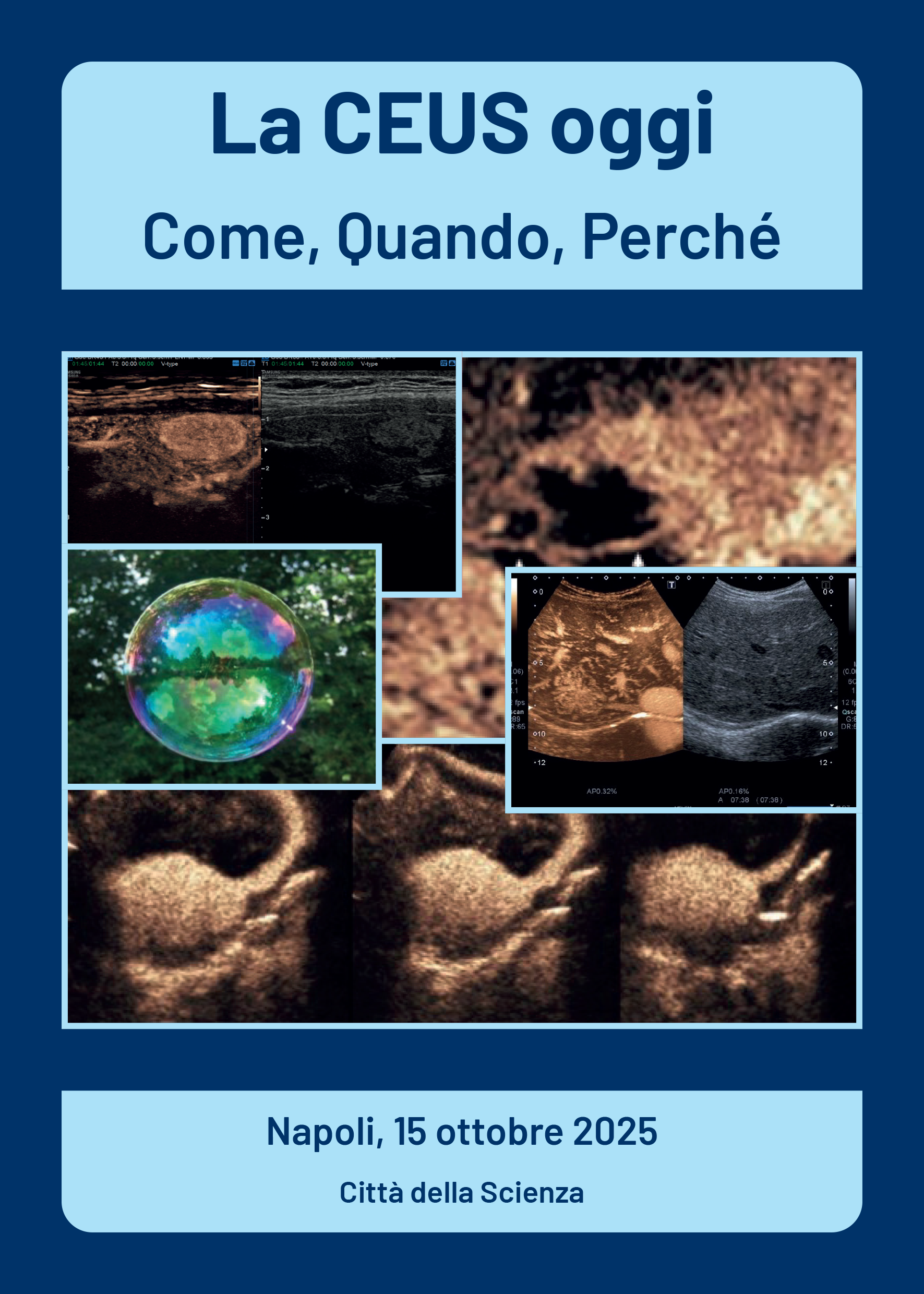 LA CEUS OGGI COME, QUANDO, PERCHÉ